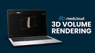 Apresentamos o 3D Volume Rendering - Medcloud