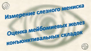 Измерение слезного мениска | Оценка мейбомиевых желез конъюнктивальных складок