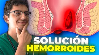 CÓMO CURAR las HEMORROIDES | TODOS los TRATAMIENTOS ¿Cuál es MÁS EFICAZ?