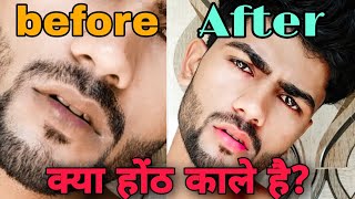 How to get soft lips in winter | lips winter care | Boys Dark lips💋 problem |