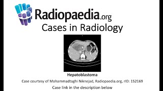 Hepatoblastoma (Radiopaedia.org) Cases in Radiology