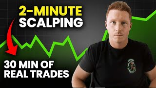 Watch My $1,000/Day Scalping Strategy LIVE (5 Real Trade Examples)