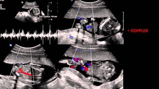 IMÁGENES EN OBSTETRICIA