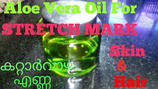 Get Rid Of Stretch Marks With Homemade Aloevera Oil.