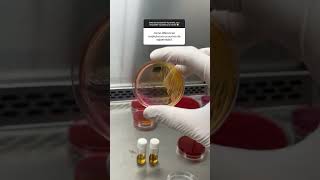 Identificando Staphylococcus com a prova da coagulase, beta hemólise e manitol 😍