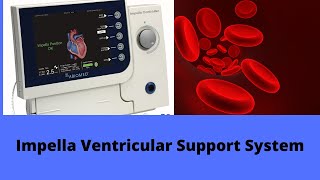 Impella Ventricular Support System