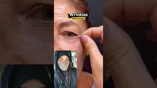 Wrinkles Removal Cream 💯 work #wrinkles #skincare #beautytips #skinwhitening