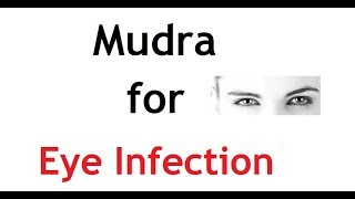 Mudra for Eye Infection