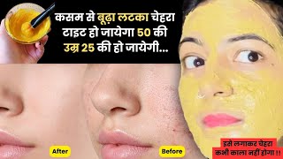 Magical Multani Mitti Facepack 🌟 Get Glowing Glass Skin Remove Pigmentation, Tiny Bumps & Open Pores