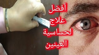 علاج فوري لحساسية العين (احمرار. حكة. انتفاخ...)دواء بدون وصفة طبيب