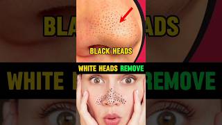 🔥2 Tips For Black heads Out 😱 | men's fashion tips bangla#shorts#shortsfeed#mensfashion