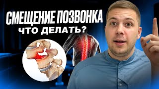 СПОНДИЛОЛИСТЕЗ. Что такое НАСТОЯЩЕЕ смещение позвонка? Что с этим делать?