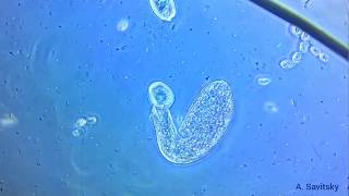 Инфузория Spathidium съедает инфузорию Сувойку. / Ciliate Spathidium eats ciliate Vorticella.