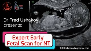 NT expert: Scanning and Management of the Fetus with Increased Nuchal Translucency - 2021