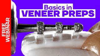 Basic principles in veneer preps. FREE Webinar