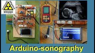 ultrasonic body sonography with arduino - part 2