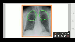 Practical medicine: X-ray Practice - 4