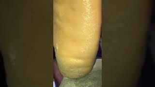 Amazing callus removal 😳😳| pedicure in Nigeria 🇳🇬 #footcare #footspa #foot #pedicure #skincare