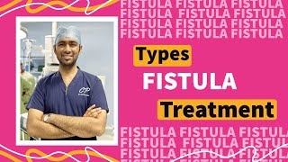 Fistula Treatment Options ? Best Technique kaunsi hai ?