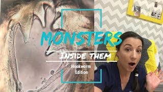 Monsters inside them?!?