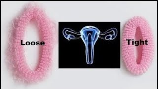 How to tighten loose Vagina Best treatment for loose Vagina 3 easy Post