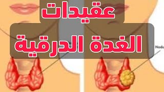 عقيدات الغدة الدرقية