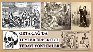 Orta Çağ 'da Uygulanan Tüyler Ürpertici Tedavi Yöntemleri! (İnanılmaz)