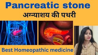 Pancreatic stone treatment !! Pancreatic stone symptoms,causes & Homeopathic medicine (in hindi)