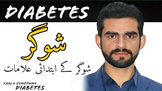 Diabetes Mellitus early symptoms || Symptoms of Diabetes || DM