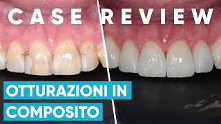 OTTURAZIONI IN COMPOSITO - Come abbiamo risolto il caso di Nicola | Case Review #5