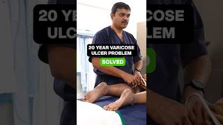 Miracle Cure for Chronic LEG ULCER! #shortsviral #varicoseveinstreatment #IVUS