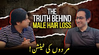 Mardoon Ki Tension! The Truth Behind Male Hair Loss!!