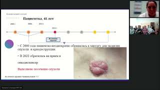 Редкие опухоли. Десмоид (вебинар 19 июня 2024)