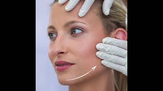 Facial Harmonisation