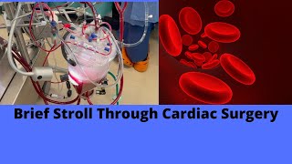 Brief Stroll Through Cardiac Surgery