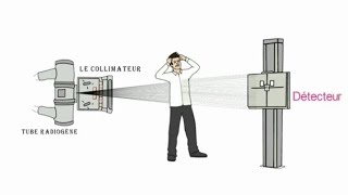 les flous en radiologie