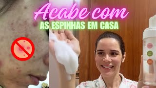 SABONETE CASEIRO - XÔ ESPINHAS,REJUVENESCE E HIDRATA