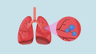 Así funcionan tus pulmones por dentro 🫁