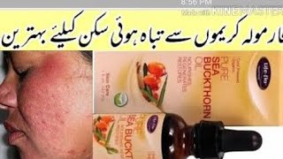 How get rid frackle pigmentation acne scar and repair demage skin