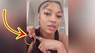 NOT FAKE : Angel Reese Explains Her Wrist Season Ending Injury On Instagram