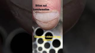 Bitten nails transformation 1 week growth | full video on my Channel