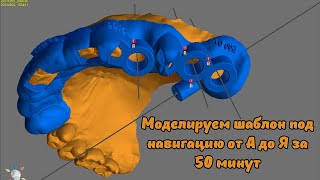 Планируем хирургический шаблон за 50 минут! Возможности программы Blue Sky Bio и Meshmixer