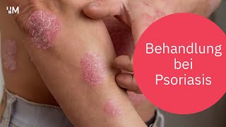 Psoriasis: Behandlungsmöglichkeiten, wenn die Haut in Flammen steht | Schuppenflechte