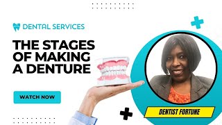 DO YOU KNOW THE STAGES OF MAKING A DENTURE 2024? | DENTIST FORTUNE