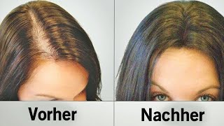 Diese natürlichen Hilfsmittel stoppen Haarausfall