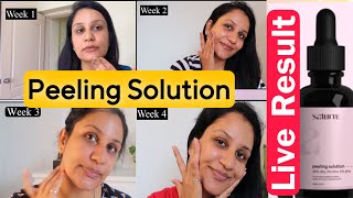 Chemical Peeling Solution For Exfoliating Skin Saturn Peeling Solution Review Best Peeling Solution