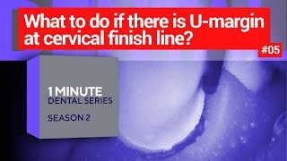 What to do if there is U-margin (undercut) at cervical finish line? 1 dental minute