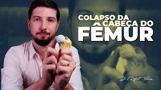 COLAPSO do osso Subcondral? O que é? #necrosedoquadril | Dr Rafael Tavares - Quadril