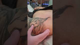 Laser Tattoo Removal Training UK 🇬🇧