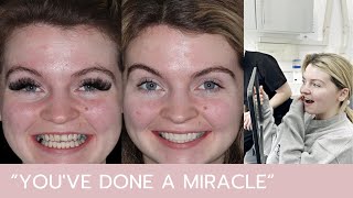 "You've done a miracle"︱Michelle's smile reveal & testimonial